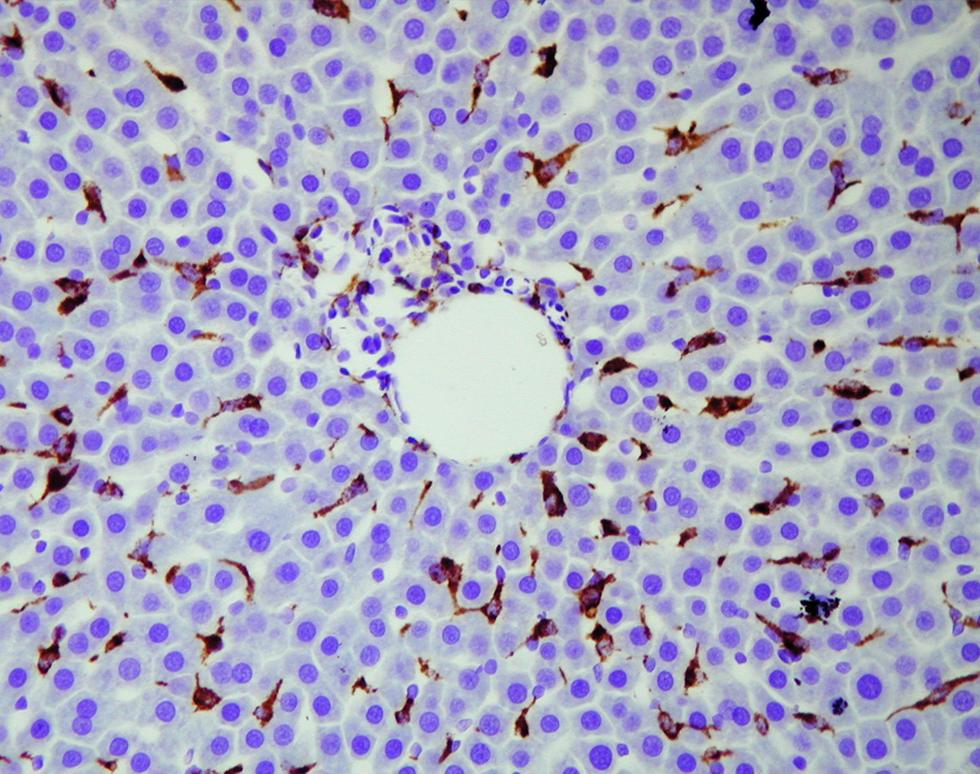 Invading Leukocytes - Joanne Rodford